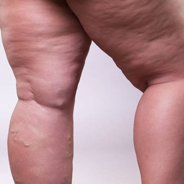 Angiologista em Barbacena