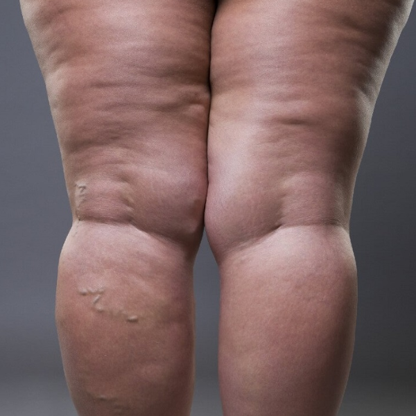 Angiologista em Barbacena